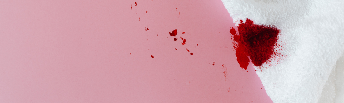 How to remove blood stains
